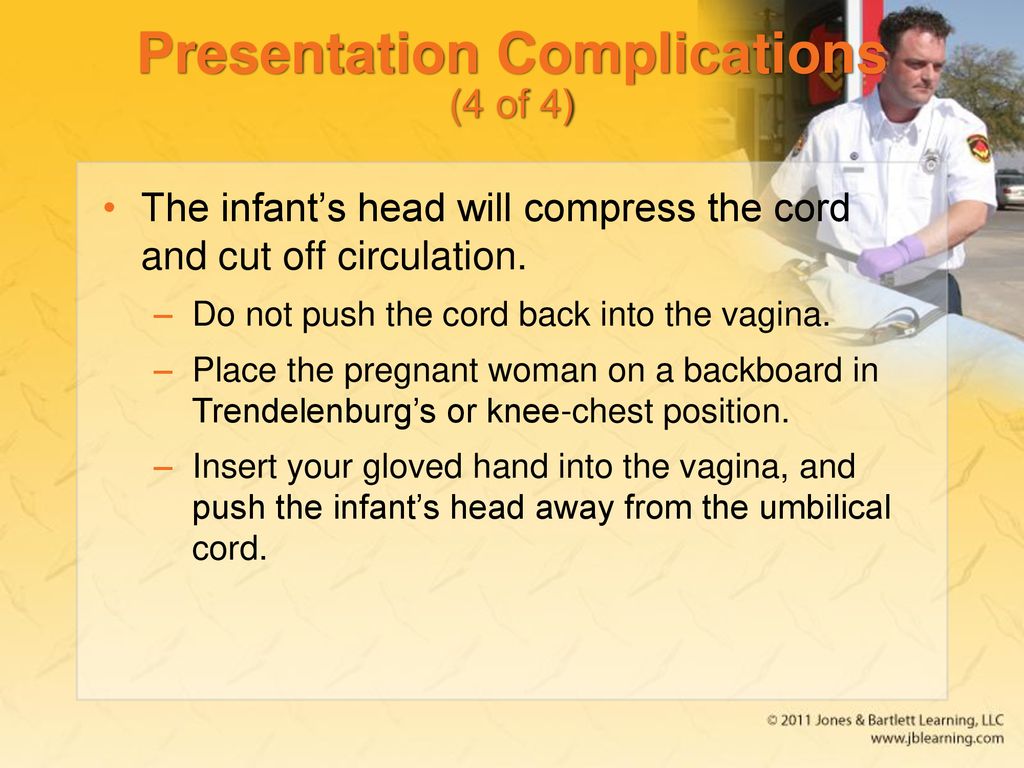 Presentation Complications (4 of 4)