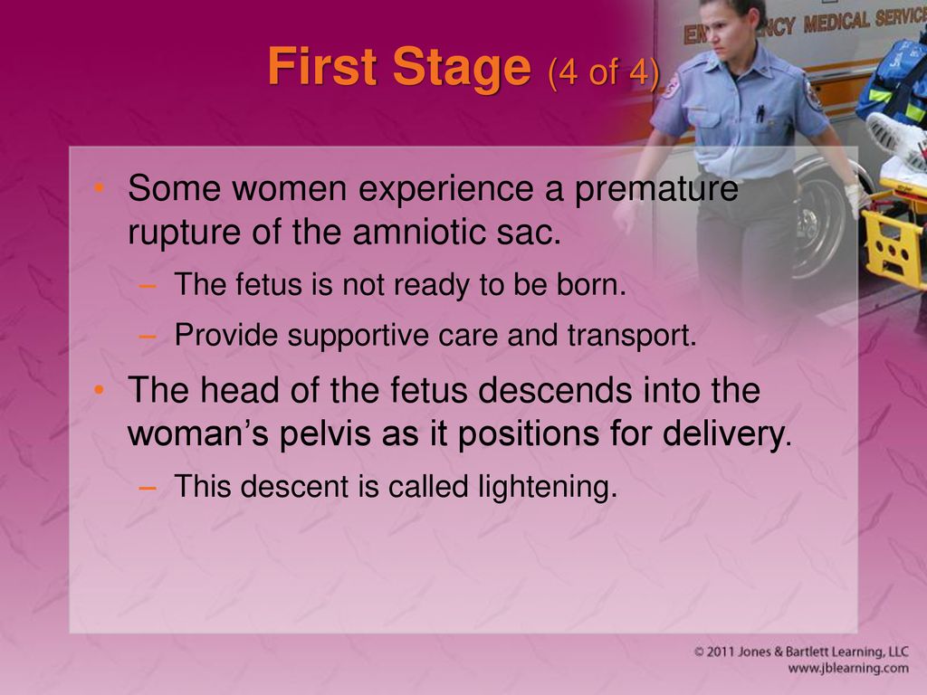 First Stage (4 of 4) Some women experience a premature rupture of the amniotic sac. The fetus is not ready to be born.