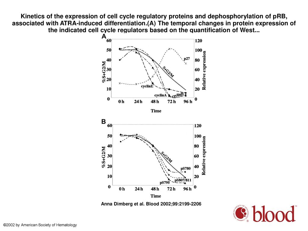Kinetics of the expression of cell cycle regulatory proteins and dephosphorylation of pRB, associated with ATRA-induced differentiation.(A) The temporal changes in protein expression of the indicated cell cycle regulators based on the quantification of West...