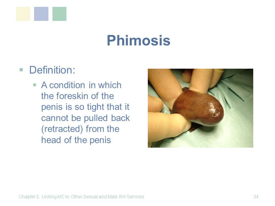 Phimosis meaning