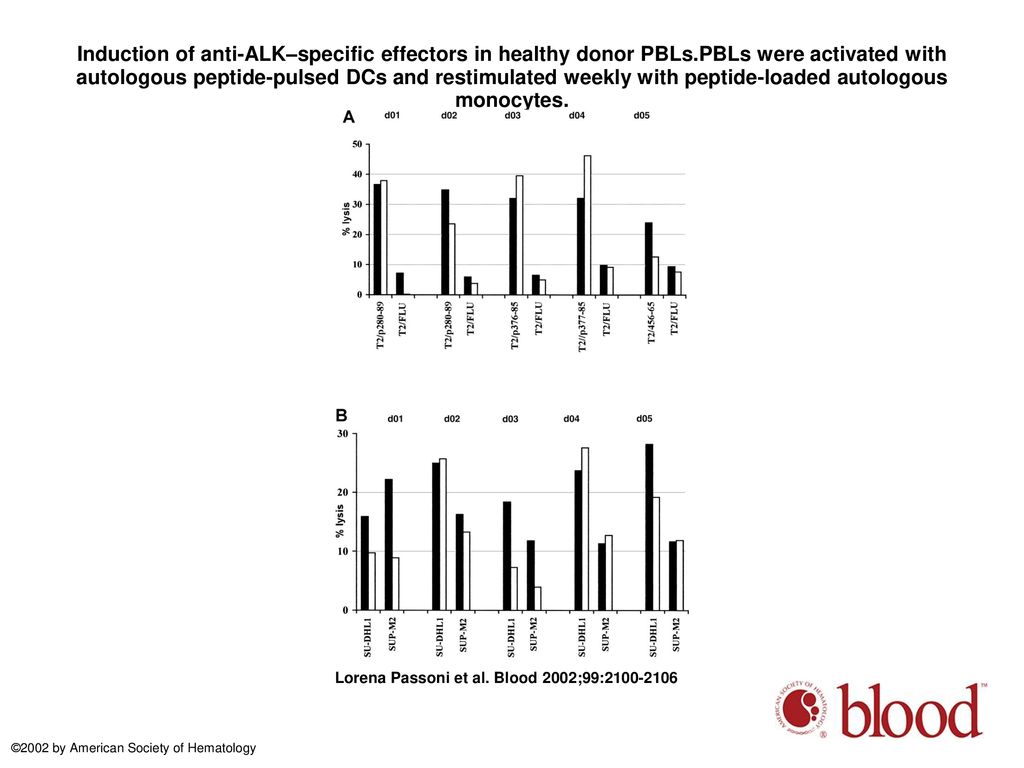 Induction of anti-ALK–specific effectors in healthy donor PBLs