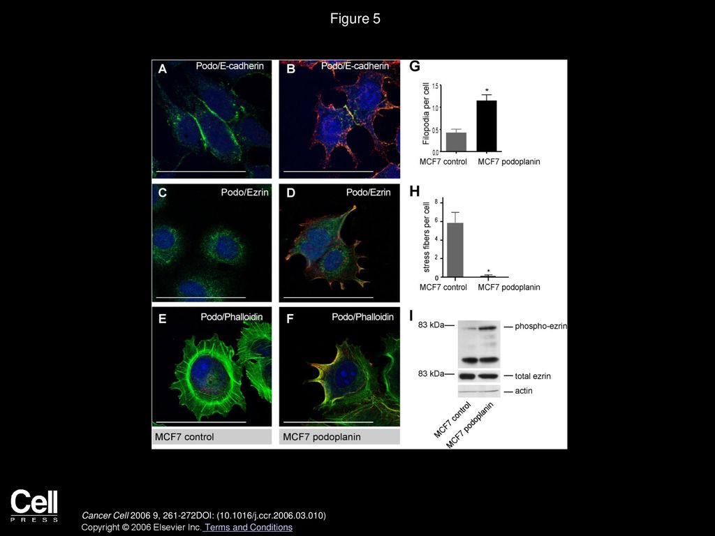 Figure 5 Podoplanin induces a migratory phenotype in MCF7 cells