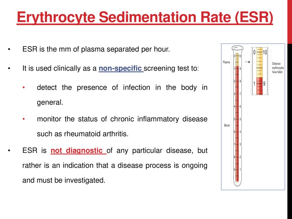 Erythrocyte Sedimentation Rate (ESR) and Hematocrit (HCT) - ppt