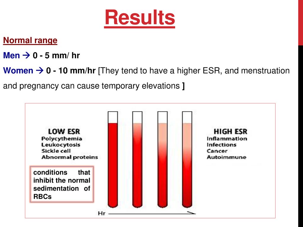 Erythrocyte Sedimentation Rate (ESR) and Hematocrit (HCT) - ppt download