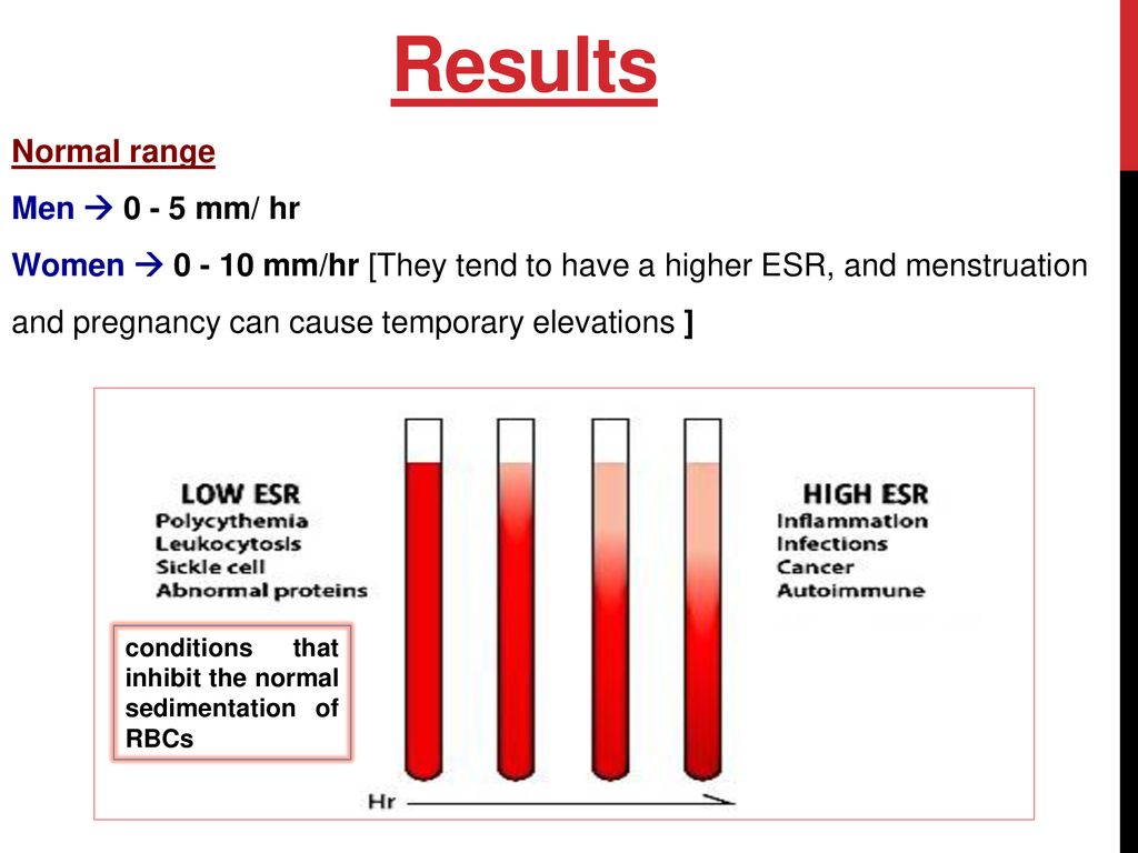 erythrocyte-sedimentation-rate-esr-and-hematocrit-hct-ppt-download