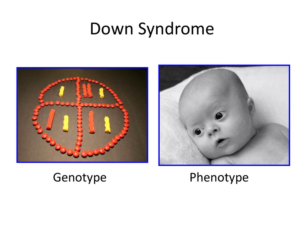 Chromosomes What Do You Notice About This Karyotype From A Human Cell Trisomy 21 3 Copies Of Chromosome 21 And The Cell Comes From A Male Xy Ppt Download