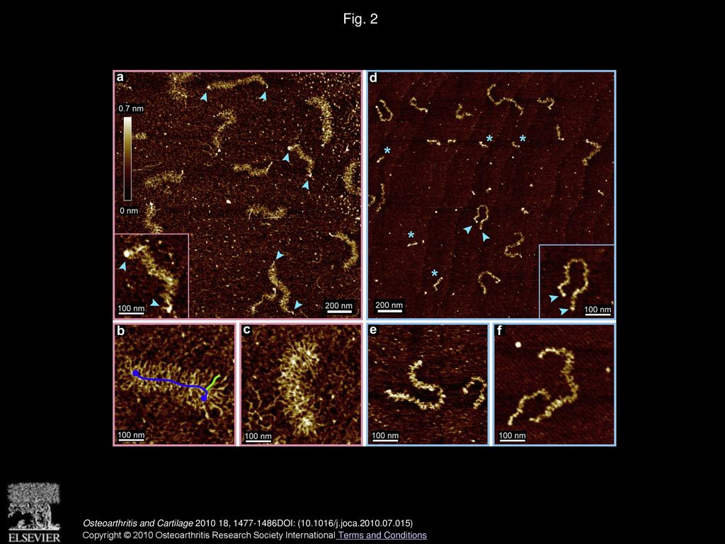 Adult Bone Marrow Stromal Cell-based Tissue-engineered Aggrecan ...