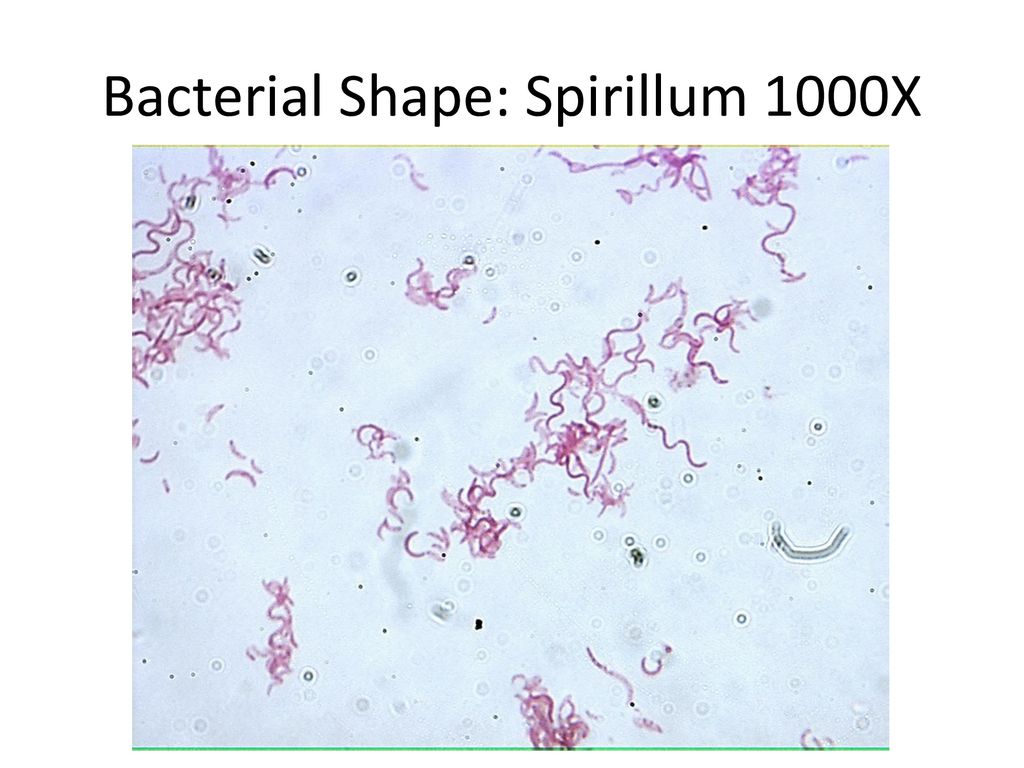 Spirilla Bacteria Under Microscope 4551