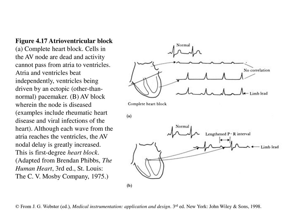 Figure 4.1 Recording of action potential of an invertebrate nerve axon ...