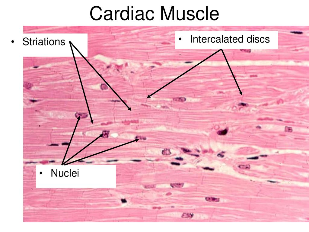 cardiac muscle striations