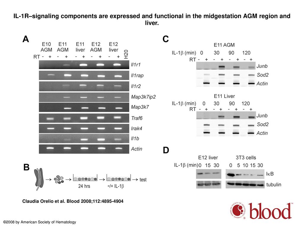 IL-1R–signaling components are expressed and functional in the midgestation AGM region and liver.