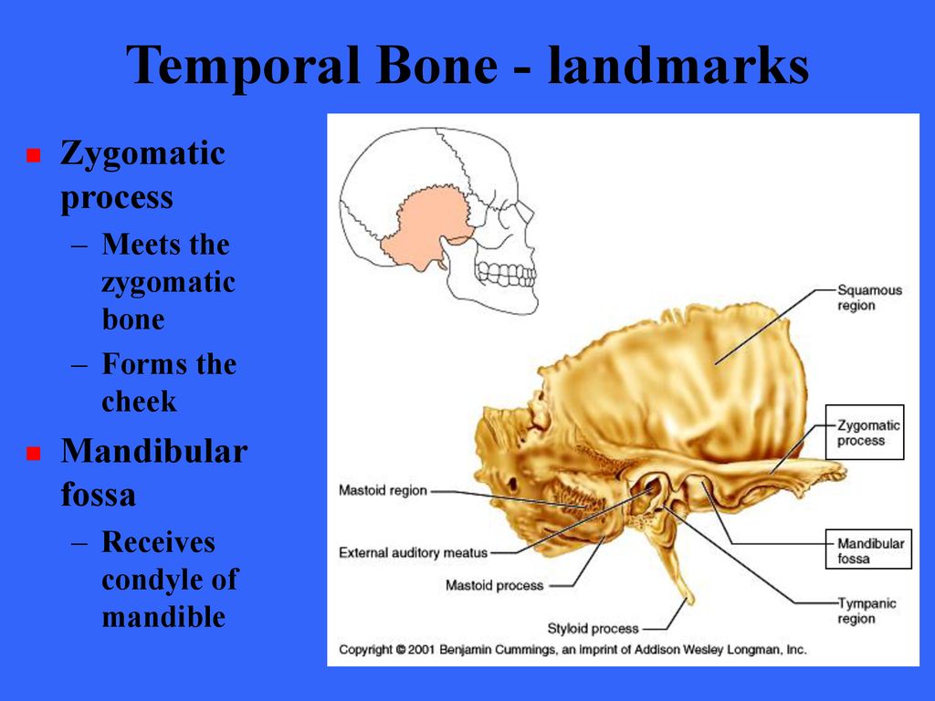 The bones form. Височная кость. Височная кость анатомия. Темпорал бонез. Temporal Bone Anatomy.
