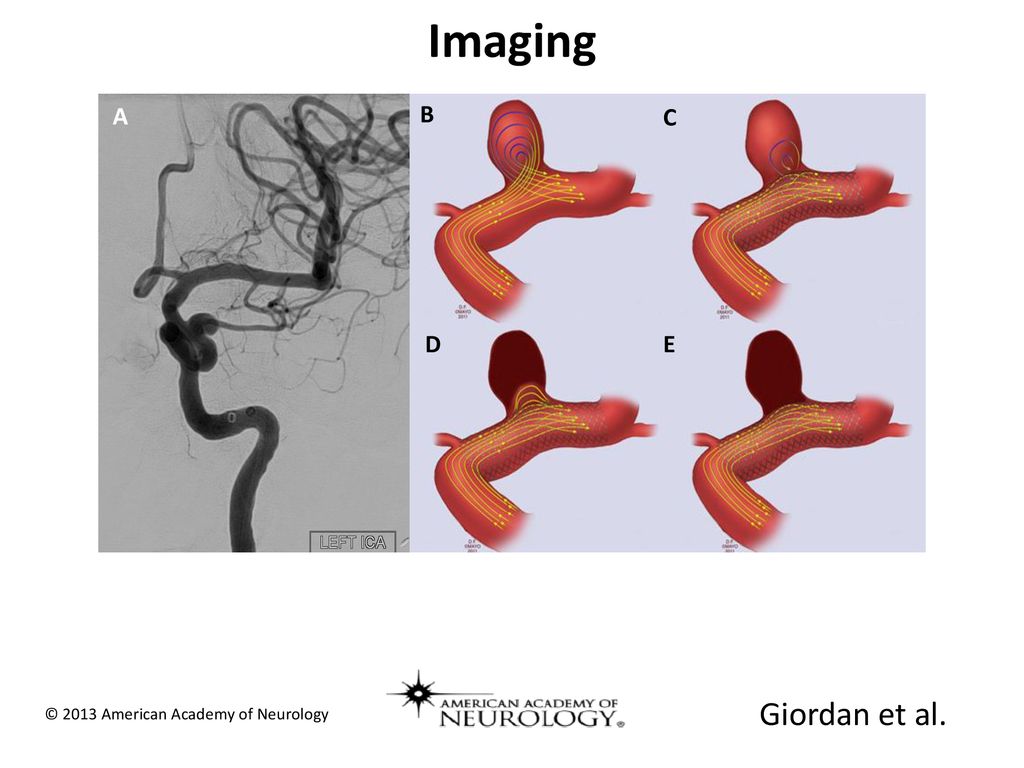 Imaging Giordan et al. A B C D E