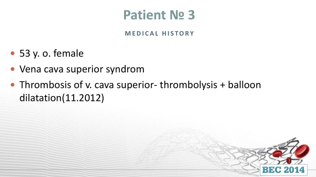 Live Cases Bec 2012 One Year Follow Up Ppt Download