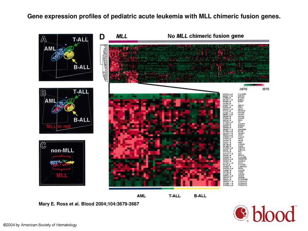 Gene expression profiling of pediatric acute myelogenous leukemia - ppt ...