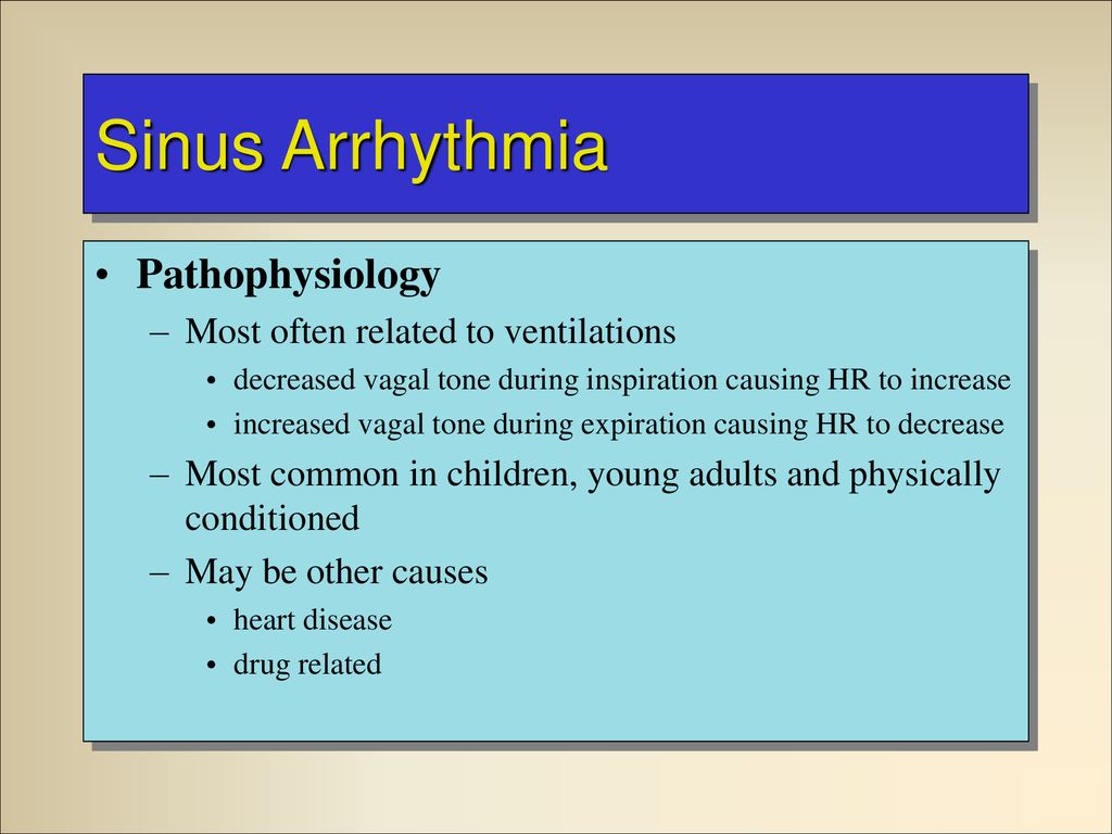 Sinus Rhythms Dysrhythmia Recognition Management Ppt Download