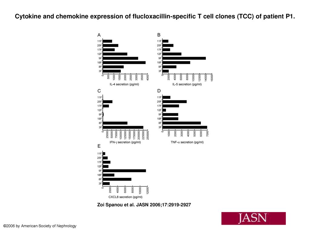 Cytokine and chemokine expression of flucloxacillin-specific T cell clones (TCC) of patient P1.