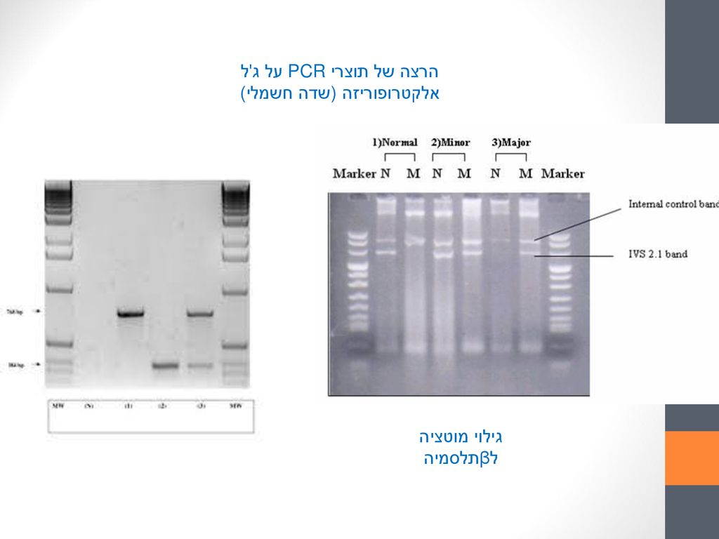הרצה של תוצרי PCR על ג ל אלקטרופוריזה (שדה חשמלי)