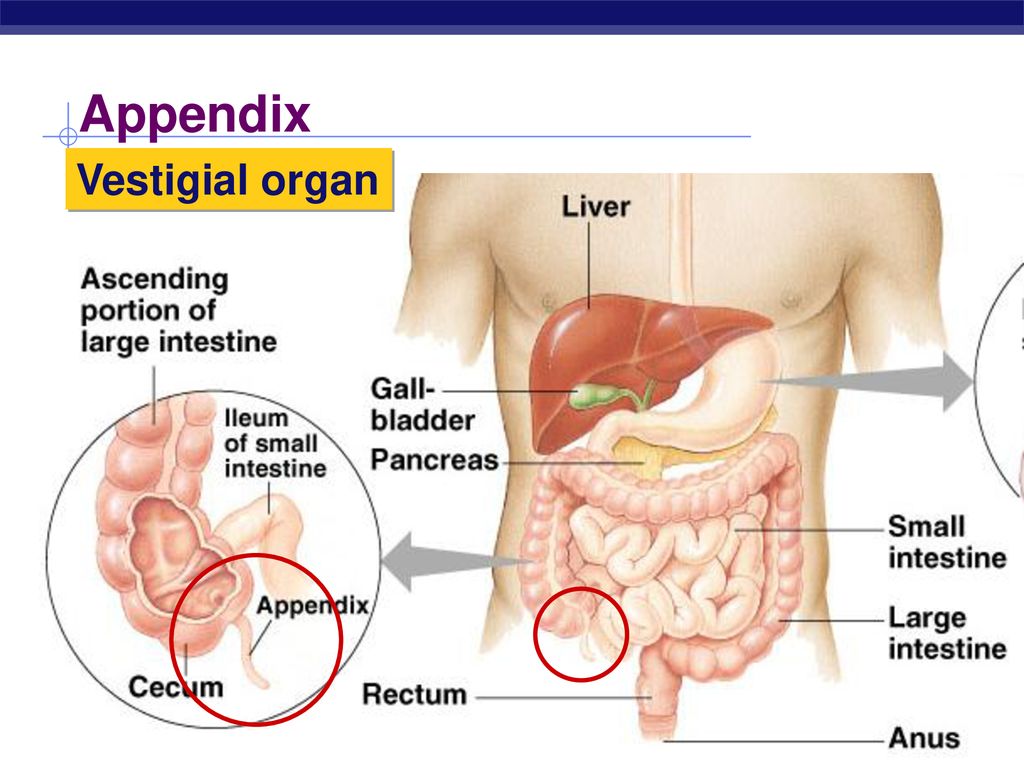 Appendix Vestigial organ