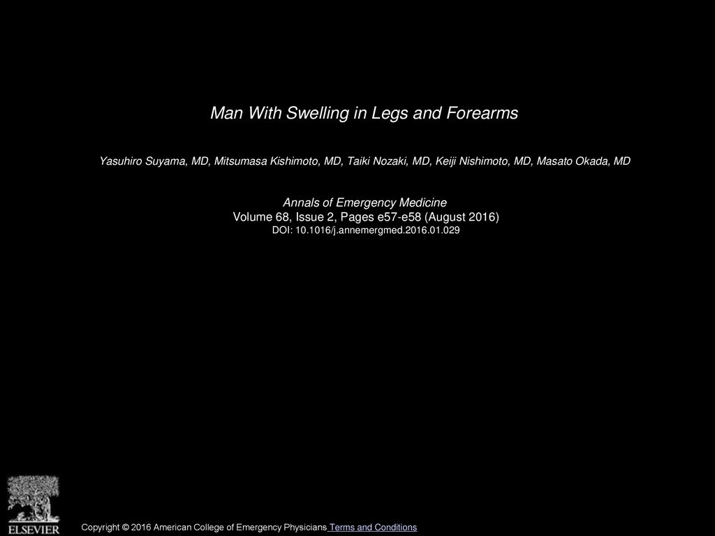 man-with-swelling-in-legs-and-forearms-ppt-download