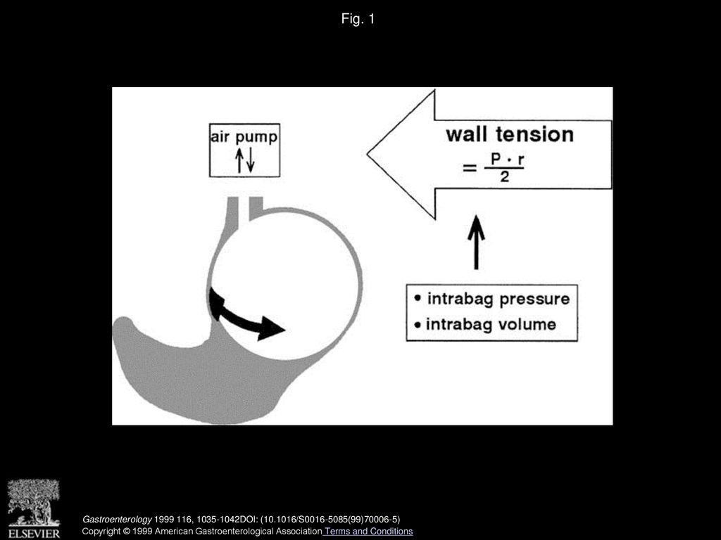 Gastric wall tension determines perception of gastric distention ppt