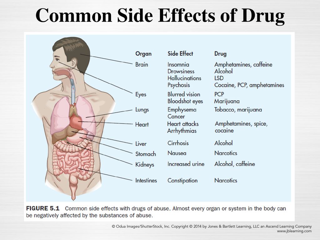 Common Side Effects of Drug.