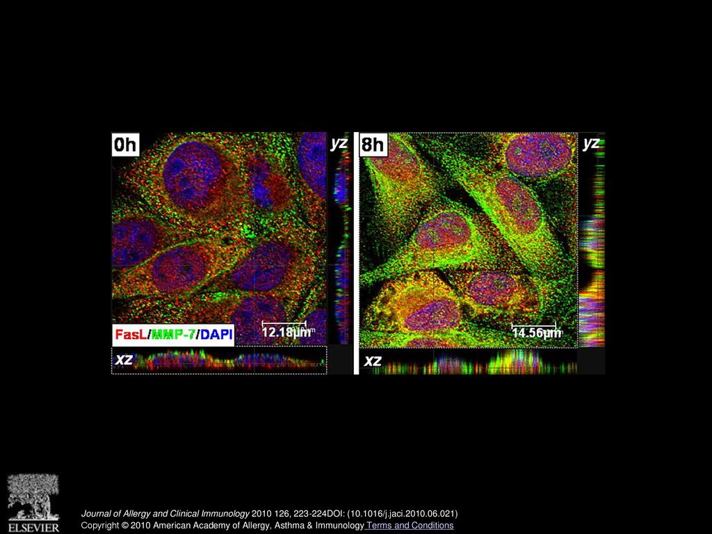 TH2 cytokines trigger colocalization of airway epithelial FasL and MMP-7.