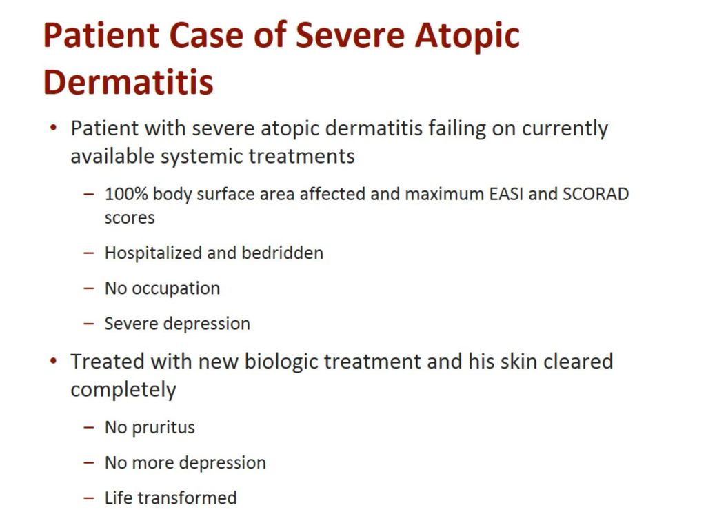 Patient Case of Severe Atopic Dermatitis