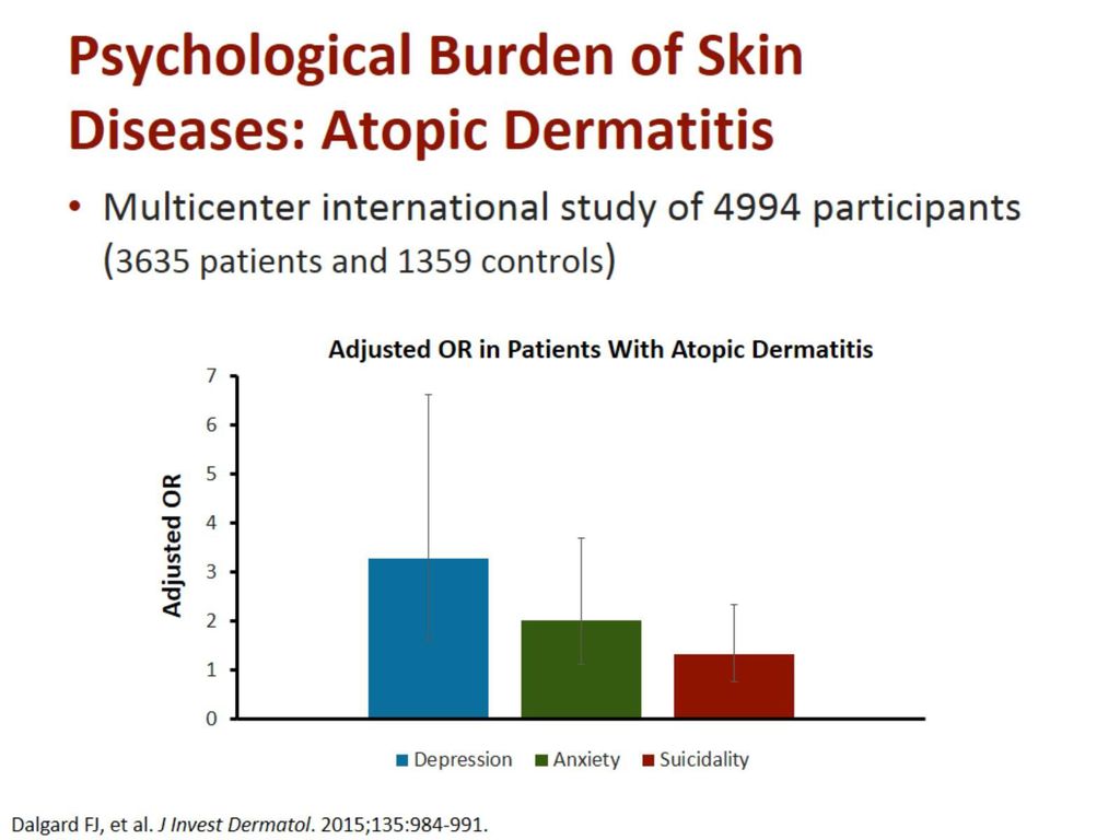 Psychological Burden of Skin Diseases: Atopic Dermatitis