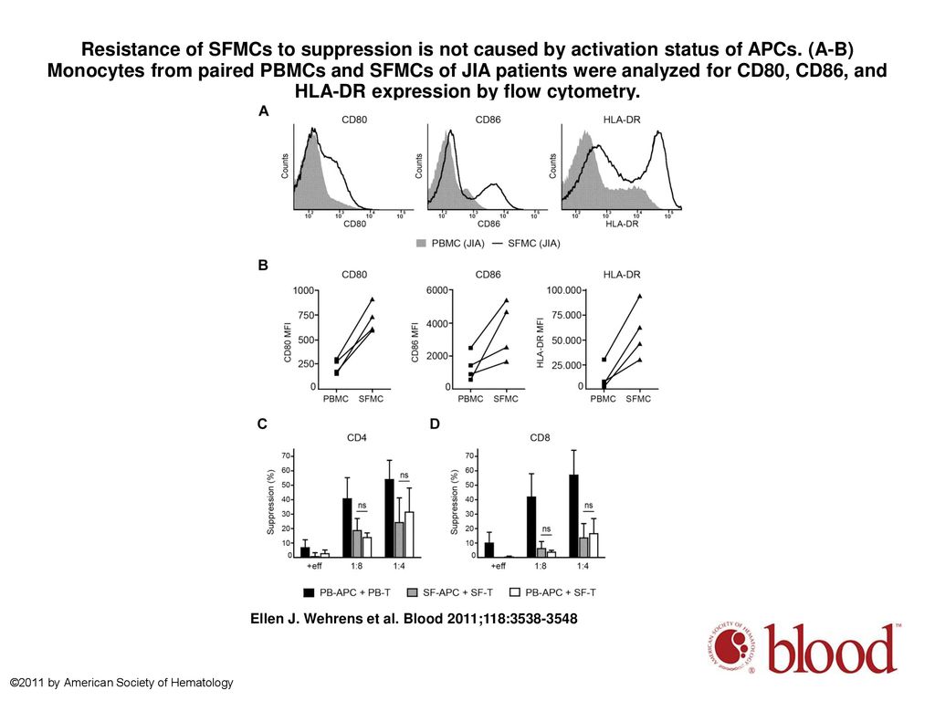 Resistance of SFMCs to suppression is not caused by activation status of APCs. (A-B) Monocytes from paired PBMCs and SFMCs of JIA patients were analyzed for CD80, CD86, and HLA-DR expression by flow cytometry.