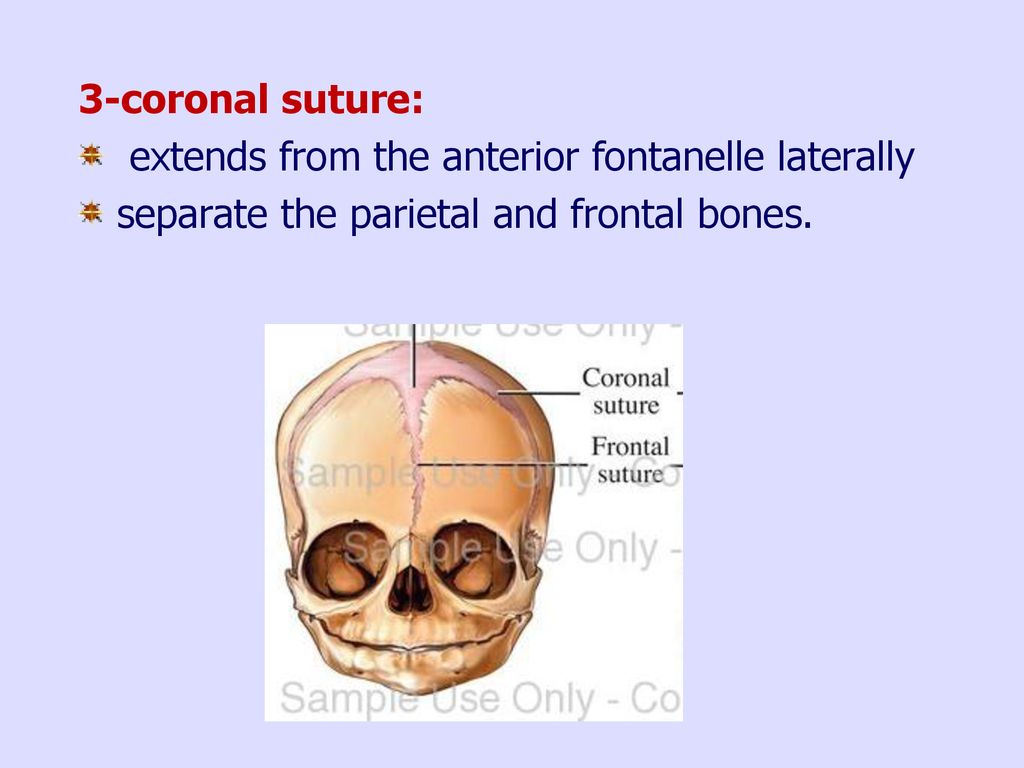 3-coronal suture: extends from the anterior fontanelle laterally.