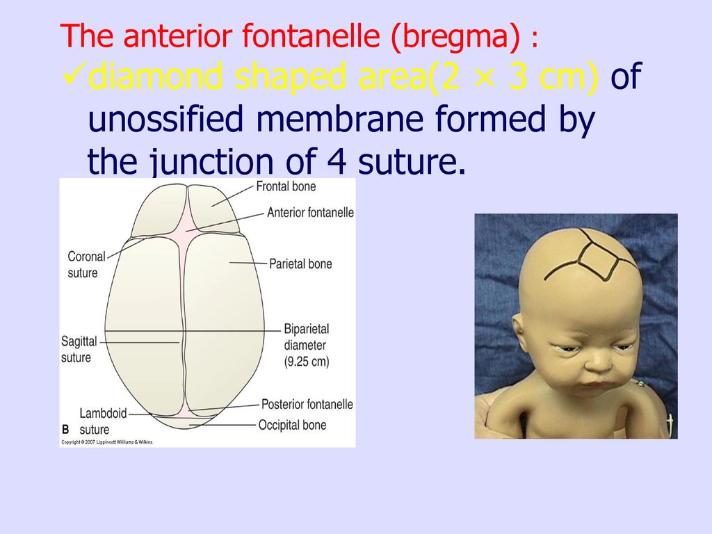 The anterior fontanelle (bregma) :