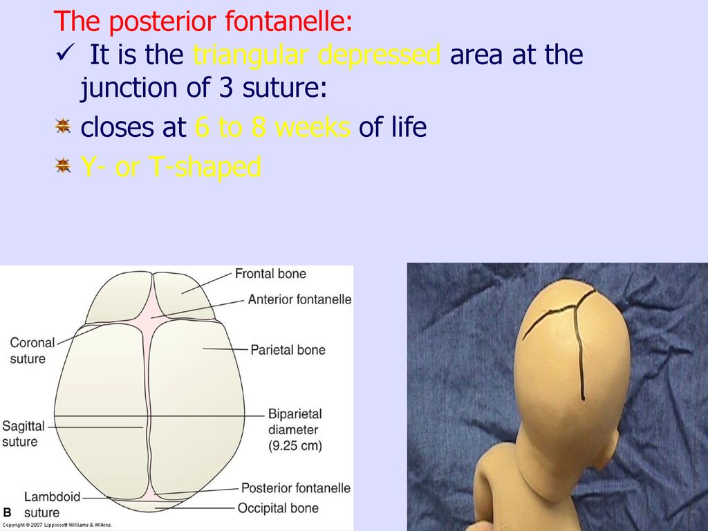 The posterior fontanelle: