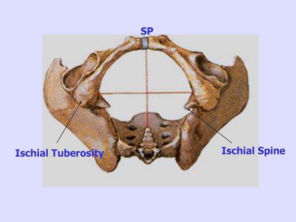 SP Ischial Spine Ischial Tuberosity
