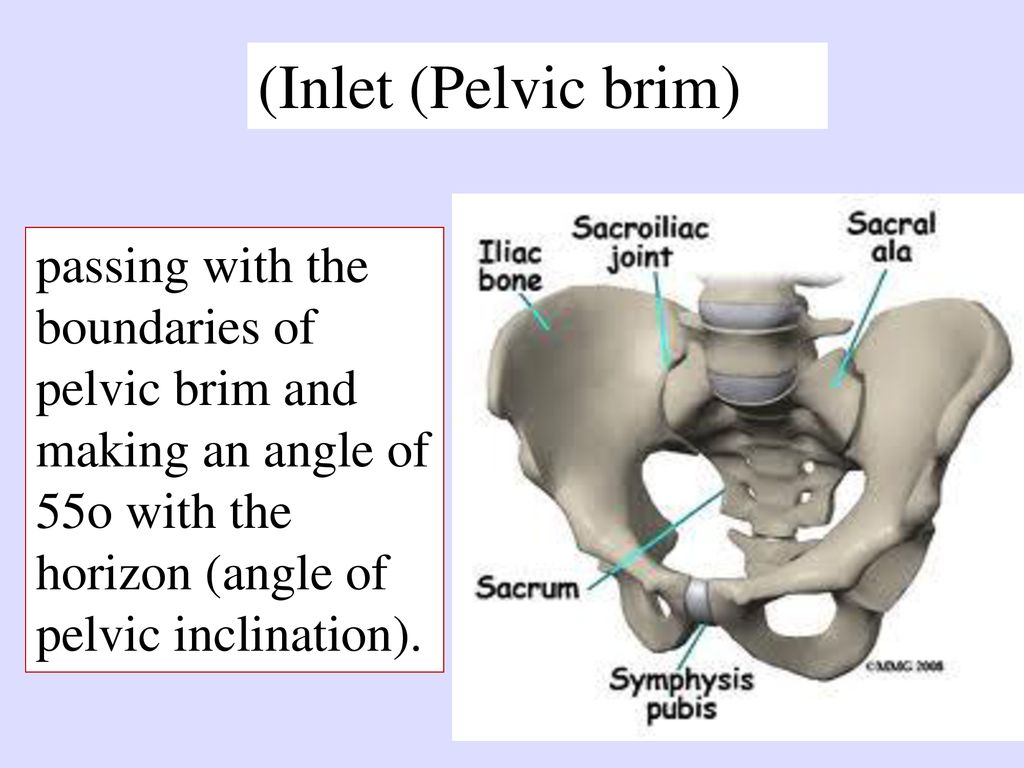 (Inlet (Pelvic brim) Bounded by.