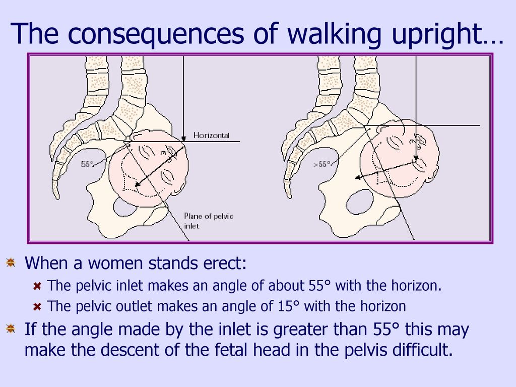 The consequences of walking upright…