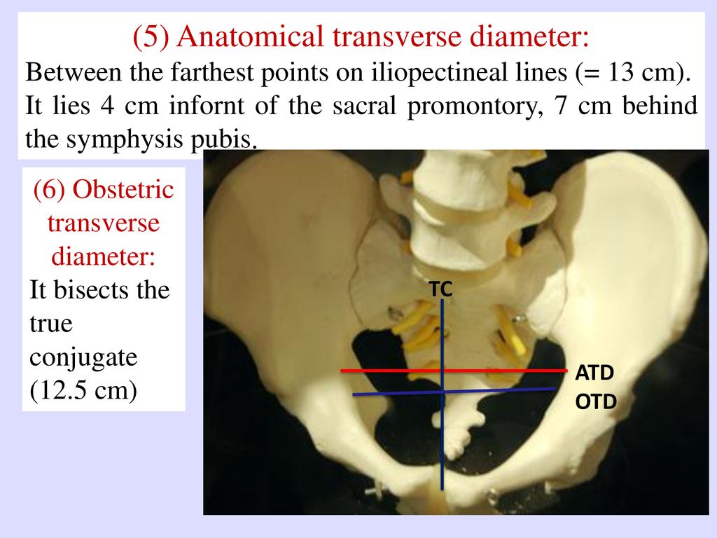 (5) Anatomical transverse diameter: