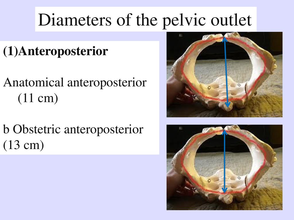 Diameters of the pelvic outlet