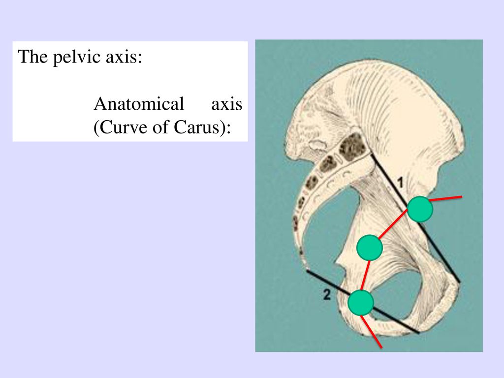 The pelvic axis: Anatomical axis (Curve of Carus):