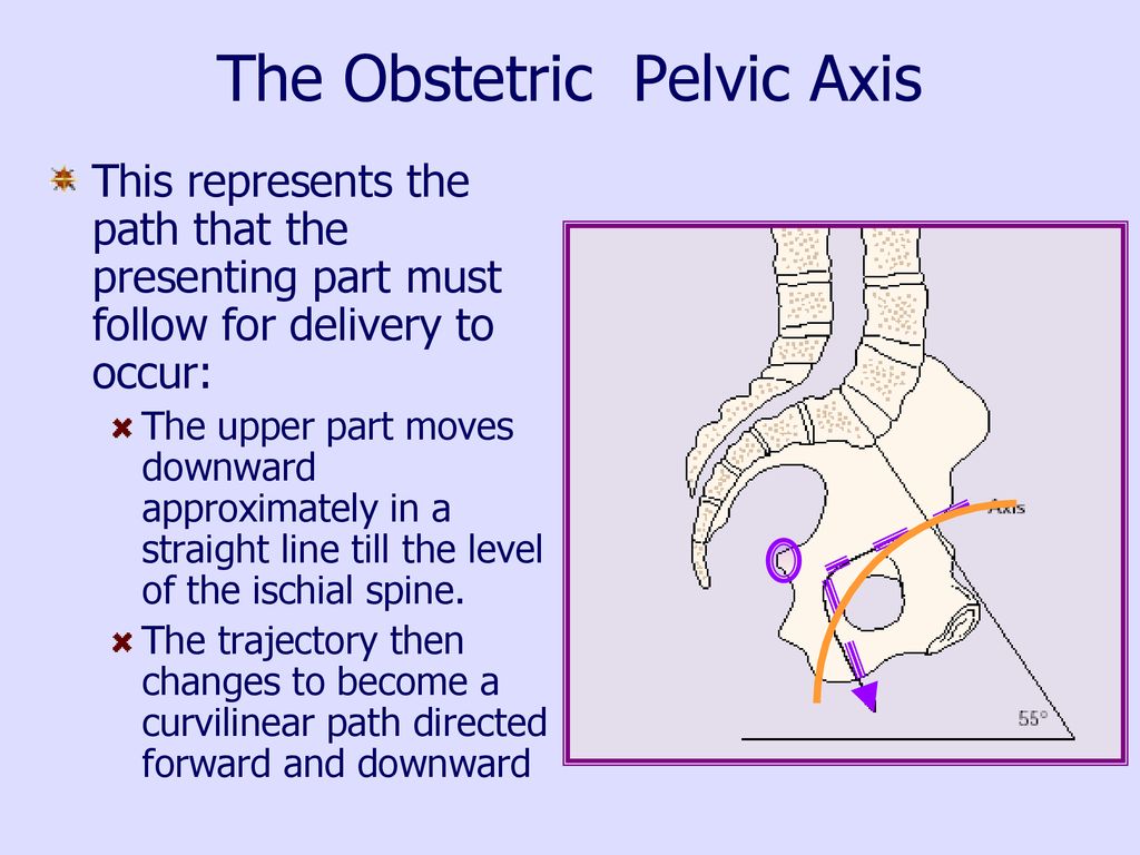 The Obstetric Pelvic Axis