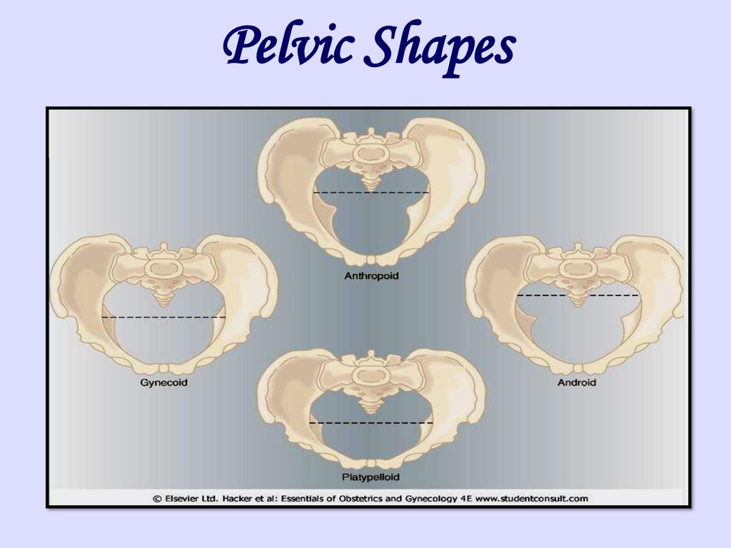 Pelvic Shapes