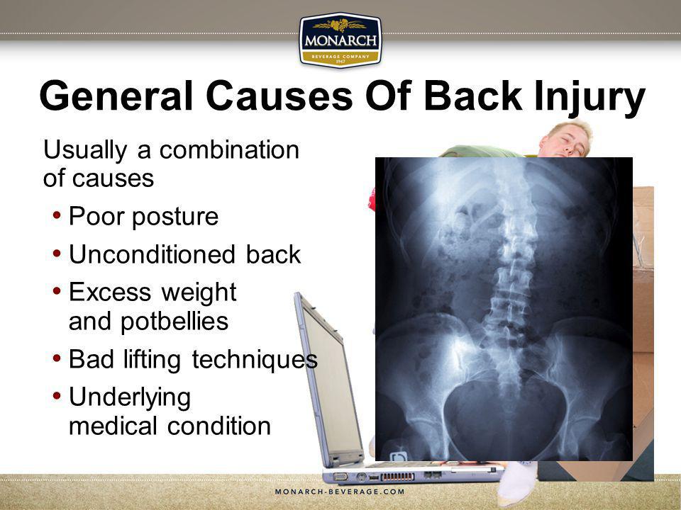 General Causes Of Back Injury