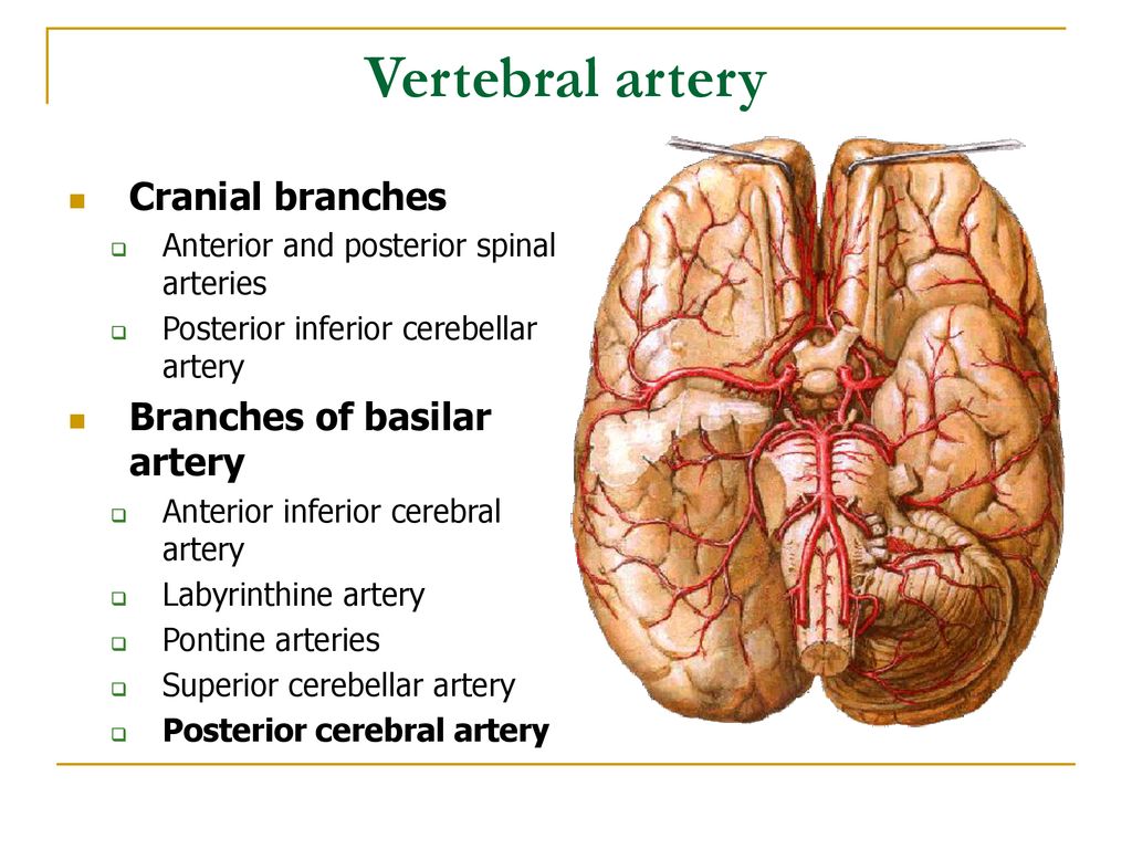 Vertebral artery Cranial branches Branches of basilar artery