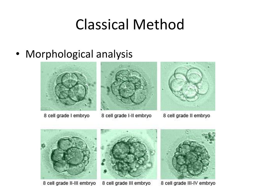 Classical Method Morphological analysis