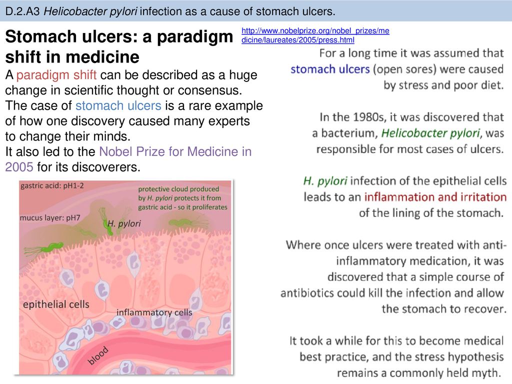 Stomach ulcers: a paradigm shift in medicine