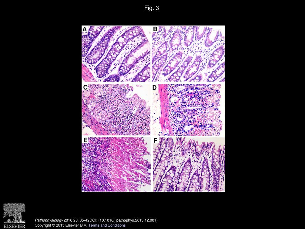 Fig. 3 Microscopic presentation of acetic acid-induced colitis in rats stained by haematoxylin and eosin (×400).