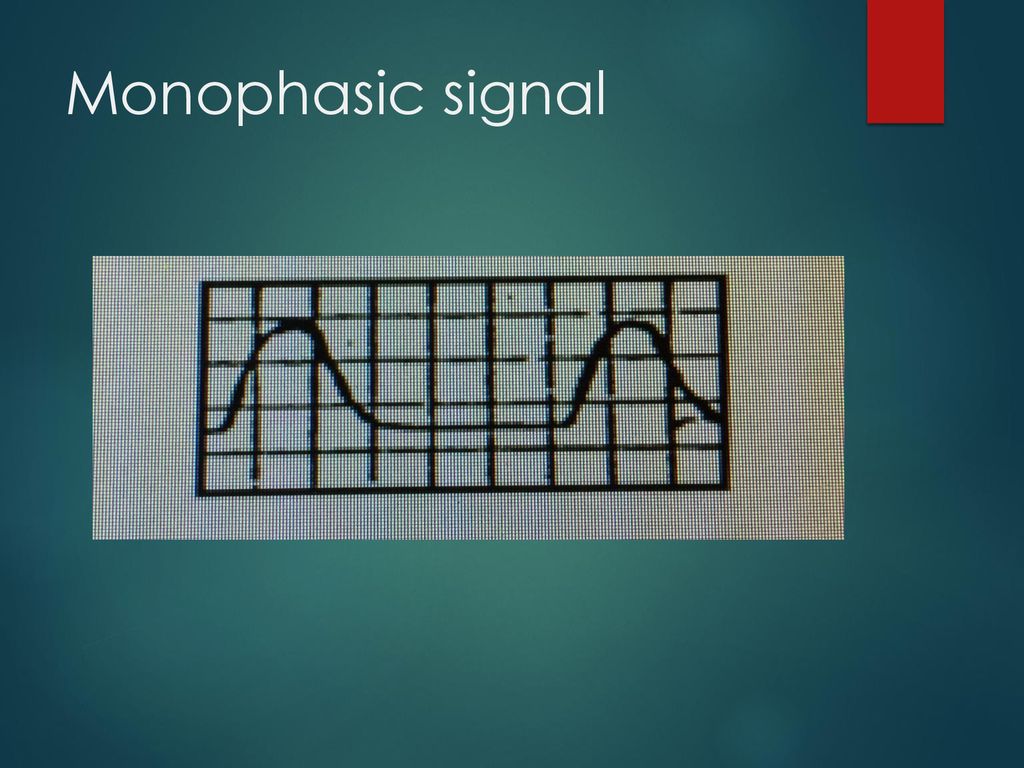 Monophasic signal