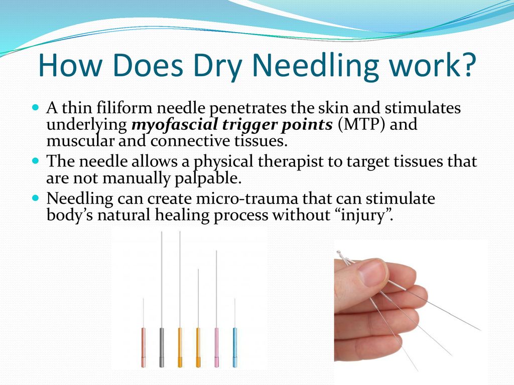 Does dry needling actually work?