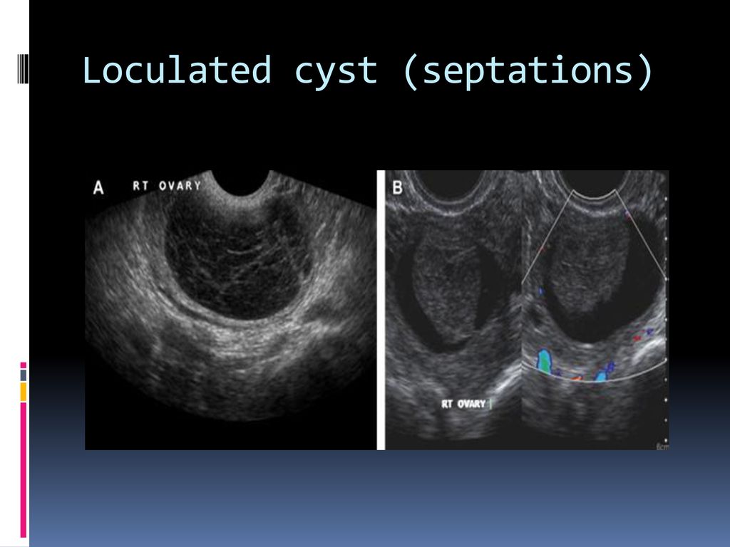 Introduction to sonography ppt download