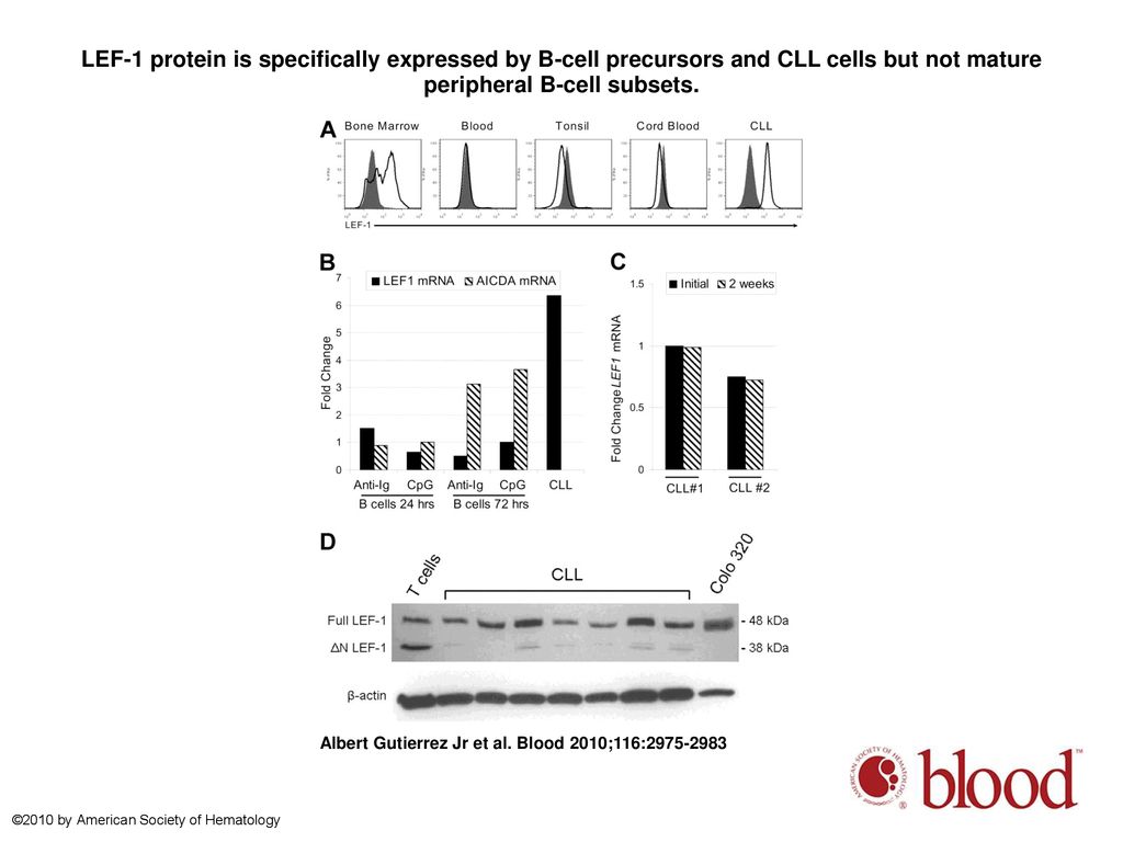 LEF-1 protein is specifically expressed by B-cell precursors and CLL cells but not mature peripheral B-cell subsets.